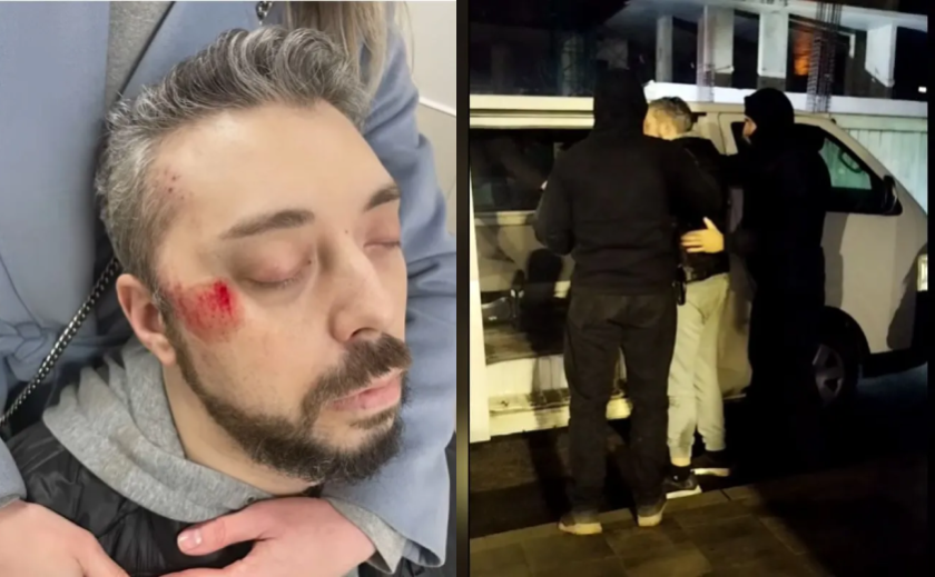 У Дніпрі чоловік впав у кому після «зустрічі» з працівниками ТЦК на проспекті Науки: офіційний коментар