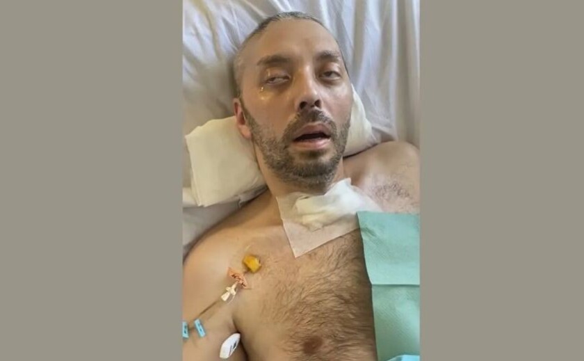 «Втратив рівновагу та впав»: у ТЦК прокоментували ситуацію з дніпрянином, який перебуває в комі після «інциденту» під час перевірки документів