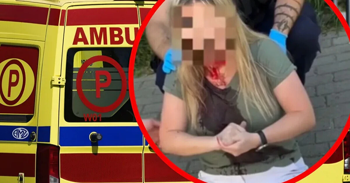 У Гдині невідомий жорстоко побив українку палицею, поліція розшукує нападника