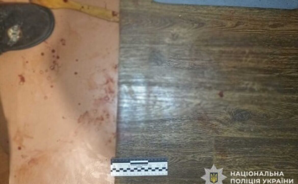 Сварка закінчилася спричиненням тяжких тілесних ушкоджень: у Нікополі правоохоронці затримали нападника